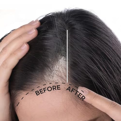 Scalp Intensive Shampoo with Biotin | Korean Shampoo for Hair Loss, Hair Regrowth, Thinning Hair, Volume Boost & Damage Repair (13.52 fl oz)