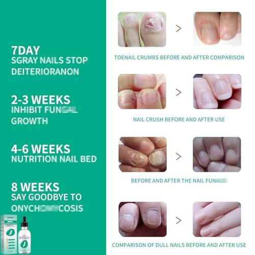 Kerassentials Toenail Oil, Kerassentials Nails colourless (3PCS)