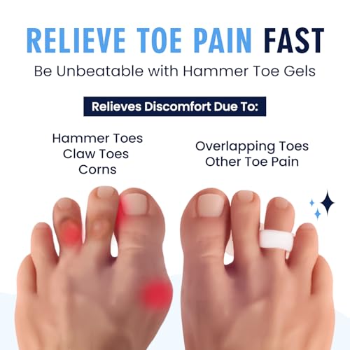 Dr. Frederick's Original Hammer Toe Gels - 2 Pairs - Hammertoe Support Crest for Women & Men - Cushion & Temporary Splint for Toe Alignment, Crooked Toes, and Pain Relief - White - 1 Loop Design
