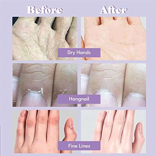 Extra Silky Hand Mask 5 Pairs, Korean Moisturizing Gloves for Dry Hands with White Truffle, Green Caviar & Peptides, Repairing and Softening Hand Care Treatment for Aging, Cracked, and Dry Skin