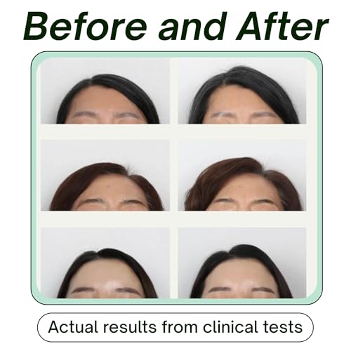 Skin Research Institute KEEWEE Hair Growth Shampoo with Biotin, Niacinamide, Green Tea & Ginkgo – Thickening for Thinning Hair & Hair Loss | Sulfate-Free, Color-Safe, Scalp-Calming