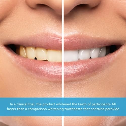 GO SMILE Teeth Whitening Gel, 3.4 OZ.