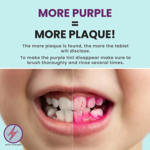 Plaque Disclosing Tablets for Teeth, 96 Count, Dental Disclosing Tablets for Kids or Adults, Shows Plaque, Helps Teach Kids Teeth-Brushing Habits for Clean Teeth, by Fresh Knight, Pack of (1)