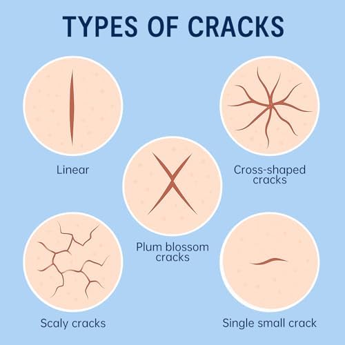 Moisturizing Crack Patches –for Linear, Single Small Crack,for Dry,Cracked Heels,Soles, Toes Skin Relief, Hydrating Care – Flexible & Breathable, 6 Patches