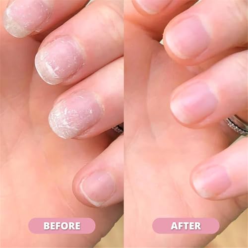 Nail 𝐆𝐫𝐨𝐰𝐭𝐡 Pen, 𝐒𝐭𝐞𝐦 𝐂𝐞𝐥𝐥 Nail 𝐆𝐫𝐨𝐰𝐭𝐡 Pen, Cuticle Oil for Nails - Strengthen Brittle Nails, Promote Fast-growth, Portable Pen for Healthy NailS (3pcs)