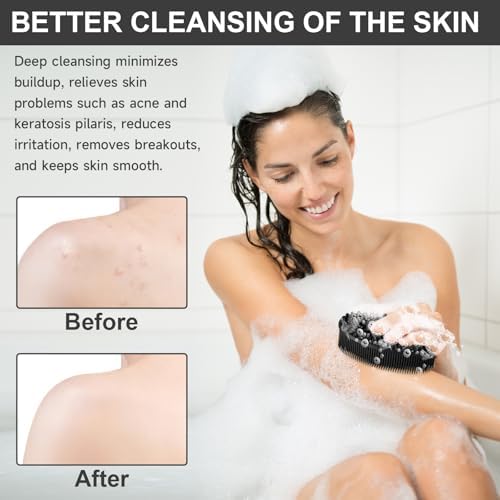 Metene 2 Pack Silicone Exfoliating Body Scrubber with Loop, Soft Body Scrubber for Men and Women, Shower and Bath Skincare Routine (Black)