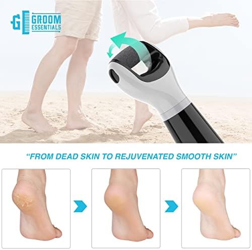 Groom Essentials Mens Callus Remover for Feet | Battery-Operated Electric Foot Callus Remover, Foot File | Pedicure Tools for Feet – 2 Spinning Pumice Heads for Cracked Skin | Pumice Stone for Feet