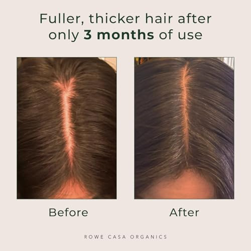 Rowe Casa Organics Natural Restorative Hair Spritz with Witch Hazel & Therapeutic Essential Oils, Hand-Crafted Hair Volumizer, Thickener, & Growth Booster, 8 Fl. Oz.