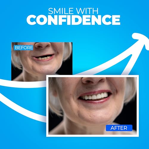 DIY Dentures, Customizable Kit with 12 Pieces, Simple to Use. Dentures Upper and Lower, Home Denture Solution for an Ideal Smile, Women and Men