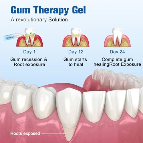 Taileden Gum Repair Therapy Gel, Taileden™ GumCareGel, Gum Shield Therapy Gel for Recessed Gums,Teeth Whitening Essence Pen Reduce Yellowing Oral Care