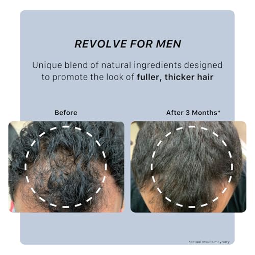 ACTIIV Recover Thickening Shampoo Treatment For Men | Supports the Appearance of Fuller, Healthier-Looking Hair, Supports Scalp Health, Plant-Based, Color-Safe, Vegan,All Hair Types