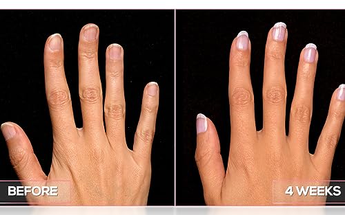 Perfect Formula Nail Collection - The Perfect Keratin Nail Treatment Manicure - A "Suit of Armor for Your Nails" - 4 pieces.