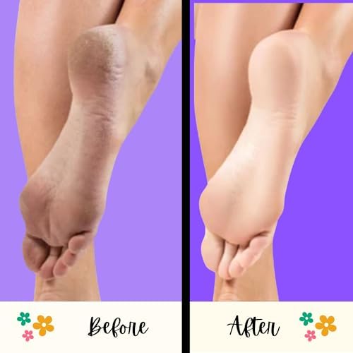 Mr. Pumice Ultimate PUMI Bar: 2-in-1 Dual-Grit (Medium + Coarse) Callus Remover, Pedicure Stone & Ped File Scrubber for Smooth Feet and Heels, (12-Count Display Box)