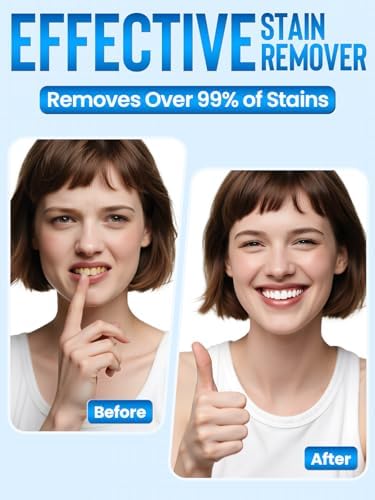 Nicwell Teeth Whitening Kit for Sensitive Tooth: 3 x 35% Carbamide Peroxide Gel & 1 Safe Remineralizing Pen - Teeth whitening LED light for Glow Gen Aged 18-34 - Oral Care for Dentist Office Daily use