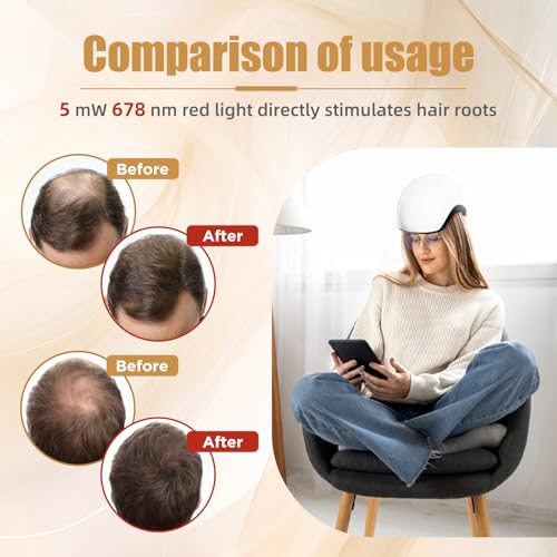 Red Light Therapy for Hair Growth Device - FDA Cleared Hair Loss Treatment - Laser Cap for Hair Regrowth - Hair Thinning & Alopecia Treatment for Men & Women