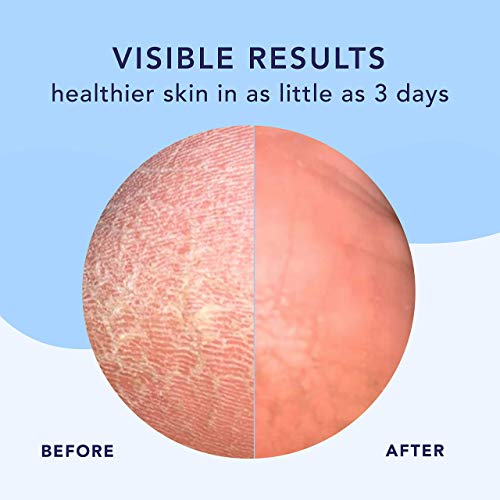 Barefoot Scientist High Dive Intensive Hydration Foot Therapy Cream, Specialized Moisture for Dry Feet and Cracked Heels