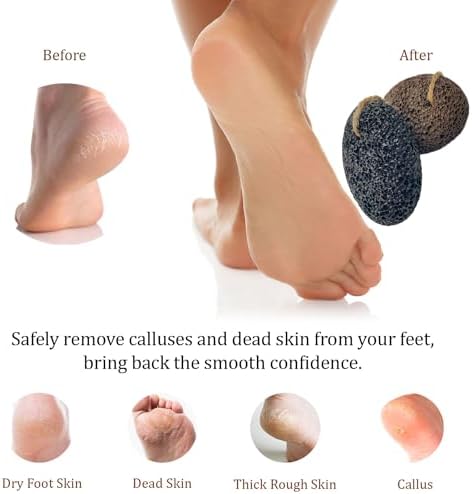 Pumice Stones for Feet - Natural Black Brown Earth Lava Stones Pack of 2 - Callus Corn Remover for Feet Heels and Palm - Pedicure Exfoliation Tool - Dry Dead Skin Scrubber - Health Foot Care