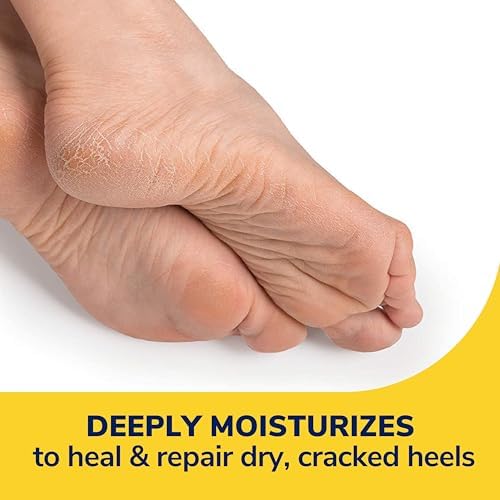 Dr. Scholl's Severe Cracked Heel Repair Restoring Balm 2.5oz, with 25% Urea for Dry, Cracked Feet, Heals and Moisturizes for Healthy Feet, Epsom Salt Soothes, Safe for Diabetics, 3-pack