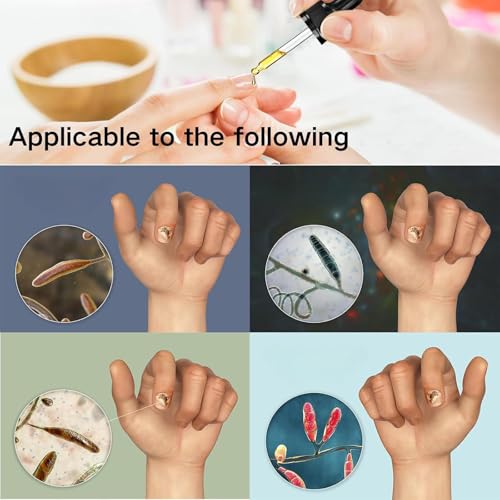 7 days Nail Growth Serum, 2PCS 7 Days Ginger Nail Essence, Multi-Purpose Nail Repair, Nail Nutrient Oil Strengthener Oil (2pcs)