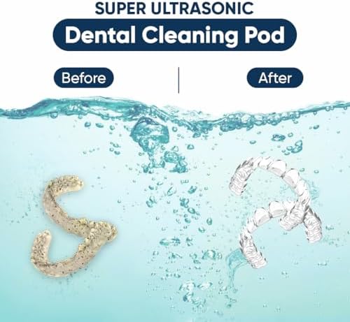 Swissklip ShinePod Ultrasonic Dental Cleaning Pod | Ultrasonic Retainer Cleaner Machine | Mouth Guard Cleaner| Night Guard Cleaner| Aligner Cleaner | Denture Cleaner - White