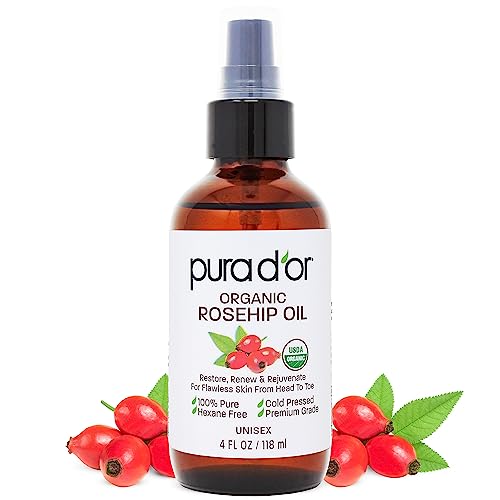 PURA D'OR 4 Oz Vitamin E Oil Blend 70,000 IU & Rosehip Seed Oil Hair Relaxer 100% Pure Cold Pressed USDA Certified All Natural Moisturizer For Anti-Aging, Acne Scar Treatment, Gua Sha Massage