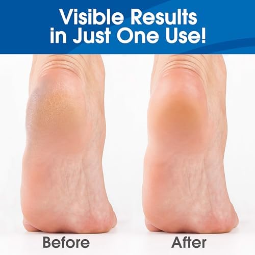 DeEnti Callus Remover for Feet, Extra Strength Foot Callus Remover Gel, 16oz Salon Grade Home Pedicure Supplies for Dry Skin, Cracked Heel, Professional Strength Foot Care, Unscented