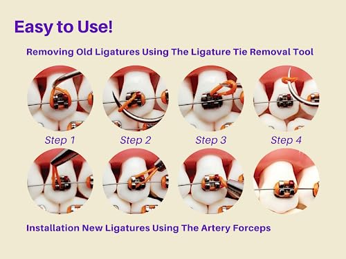 ARTMAN INSTRUMENTS Dental Braces Color Changing Kit, Orthodontic Ties Changing kit, Change The Color of Your Braces Yourself in Minutes Ligas para Brackets Ortodoncia