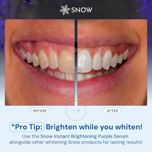 SNOW Teeth Brightening Purple Serum | Gentle & Enamel Safe Instant Brightening for Brighter Smile | Dental Care, Hygiene, & Tooth Care Bright Smile for Events Daily Confidence 2 Month Supply