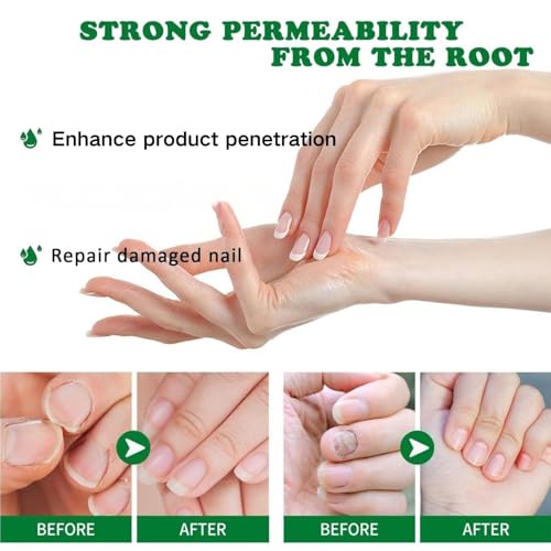 3PCS Ginger Nail Treatment, Ginger Cuticle Care Oil for Nails, Multi-Purpose Nail Repair Nutrient Oil (02)