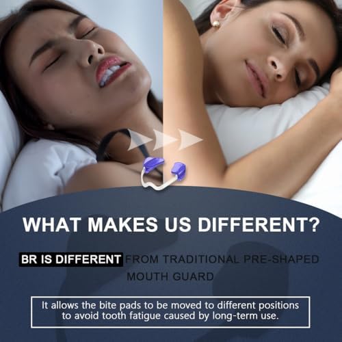 KOHEEL No-Boiling Adjustable Mouth Guard for Teeth Grinding and Clenching, Comfortable Night Guard for Bruxism Relief, TMJ Relief, and Sleep Improvement (2 Count)