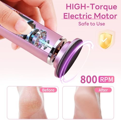 Dermave Electric Foot Callus Remover, 800RPM Electric Foot File Callus Remover for Feet with 60 pcs Sandpaper Discs, Stepless Speed Professional Foot Scrubber Pedicure Tools for Dead Skin and Calluses