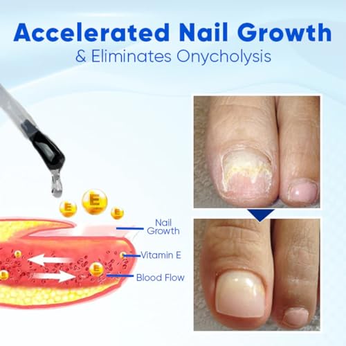 OnyxoGuard Nail Growth and Repair Serum,Nail Strengthener for Thin Nail, Brittle & Damaged Strengthener Base Coat Nail Polish Repair Nail Growth Treatment, Crystal Clear (2PCS)