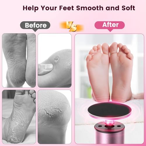 Upgrade Wireless Electric Callus Remover for Feet, 2 in 1 Rechargeable Electric Foot File Grinder for Heel Hand with 6 Speed and Sandpaper, Pedicure Tool for Feet Dead Skin