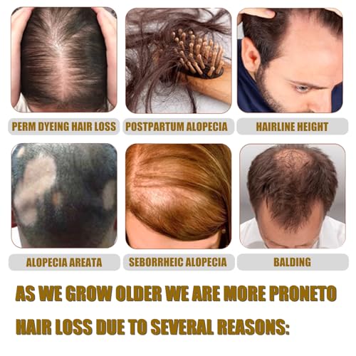 Unalakleet 100% Raw Batana Oil for Hair Growth – Botana Oil Hair Growth Treatment with Pumpkin Seed & Coffee | Vegan, Natural Hair Care for Thicker Hair | Pleasant Smell & Smooth Texture