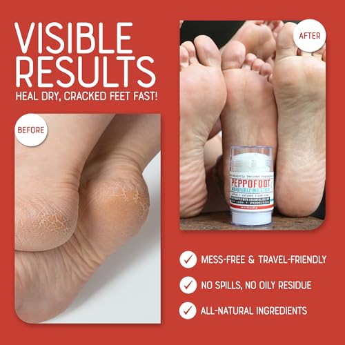 Rinse Bath & Body Peppofoot Heel Balm Stick - Handmade Heel Balm for Dry Cracked Feet with Peppermint and Tea Tree Oils | Ultra Moisturizing | No Mess Cracked Heel Stick | All Natural | 2oz