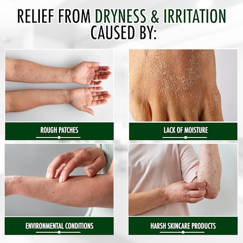 GLY MIRACLE Moisturizing Body Cream Lotion, 16 ounce - Non-Greasy Skin Humectant for Extremely Dry Skin, Hands, Body, and Feet, Fragrance-Free with Pure Glycerin for Nourishing Hydration.