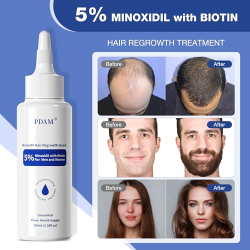 5% Minoxidil for Men Hair Growth Serum - Minoxidil for Women Serum with Biotin for Thicker & Healthier, Topical Minoxidil for Men Restore Fuller Beard
