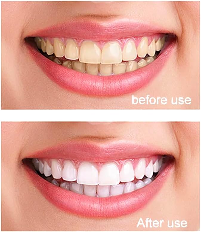 99.5% Pure Nano Hydroxyapatite Powder for DIY Toothpaste, Teeth Whitening & Soap Making 30 Grams