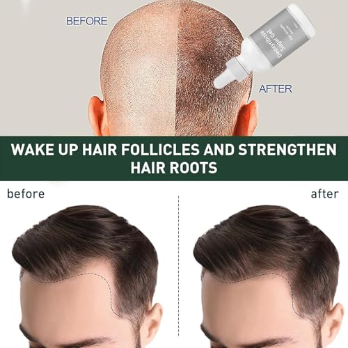 Deoxyribose Sugar Hair Growth Serum | Scalp Treatment for Thicker, Stronger Hair | Reduces Hair Loss | Nourishes with Green Tea & Ginseng Extract (1PCS)
