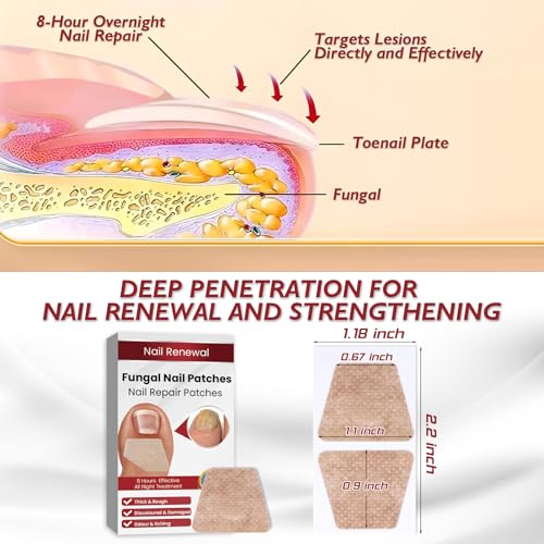 Fungus Nail Treatment Patch, Foot Fungus Treatment Extra Strength, Nail Fungal Patches for Toenail, Fungus Nail Treatment, Toe Nail Fungus Treatments, Yellow Toenail Patch for Fungi Nail
