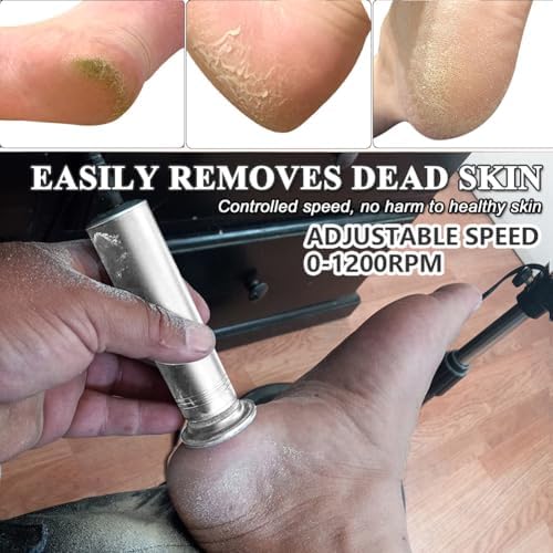 Upgraded Electric Callus Remover for Feet 1200rpm, Adjustable Speed Professional Electric Foot File Pedicure Foot Sander with 60 Replaceable Sandpaper Discs for Heel Dead Skin, Silver