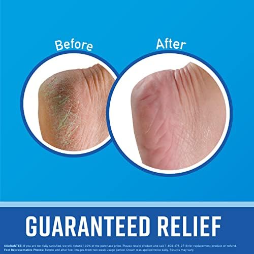O'Keeffe's for Healthy Feet Foot Cream; Guaranteed Relief for Extremely Dry; Cracked Feet; Instantly Boosts Moisture Levels; 3.2 Ounce Jar; (Pack of 4)
