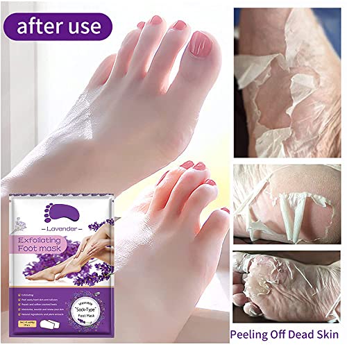 Foot Peel Mask 5 Pack,Lavender Exfoliating Foot Masks, Soft Smooth Touch Natural Exfoliator for Dry Dead Skin, Callus, Repair Rough Heels,Gifts for Women Mom and Men