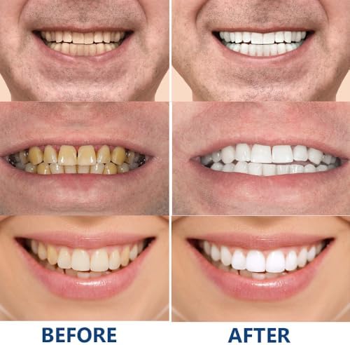 Peachloft Teeth Whitening Toothpaste, 7.5% Nano Hydroxyapatite Toothpaste,Fluoride Free Hydroxyapatite Toothpastes, White Tooth Repair | Enamel Repair & Fresh Breath (1PC-B, Large)