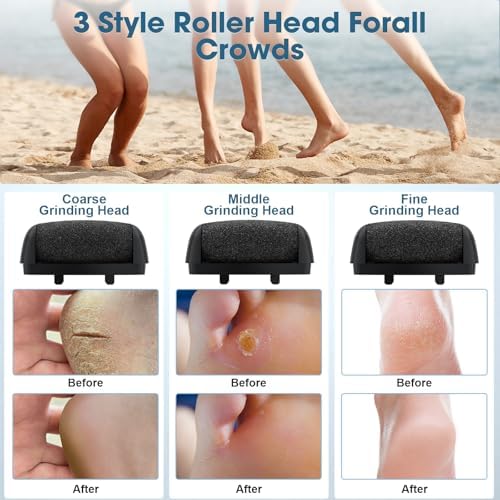 Foot Scrubber Callus Remover for Feet - with Holder & RingLight, Portable Pedicure Kit Foot File Callus Remover, Waterproof Professional Pedicure Tool Foot Care for Deadskin Hard Cracked Dry Skin