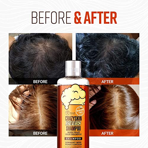 CRAZY SKIN German Beers Shampoo - 20.30 fl oz(300ml) X 2set, BIOTIN for hair loss, Rich with Beer Yeast for Regrowth and Thickening, Sulfate/Chemical free, Suitable for all hair types