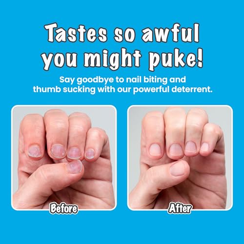 Nail Deterrent, Treatment for Kids and Adults, Non-Glossy Invisible Coating, Stop Nail Biting and Thumb Sucking Today, 0.3 Fl Oz