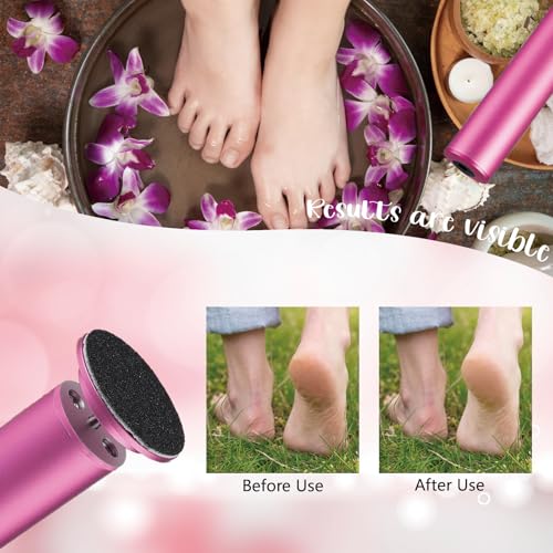 Dermave Electric Foot Callus Remover, Adjustable Speed Electric Foot File, Professional Pedicure Tool for Dead Skin,Calluses,Chapped Skin,for Women&Men,with 60pcs Replacement Sandpaper Disk
