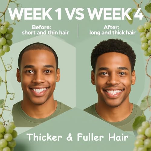 Minnah Hair Growth Oil for Black Women, Extra Strength Rosemary Fenugreek Herbal Hair Growth Oil, Natural Scalp Oils Serum with Castor Oils, Aceite de Romero para el Cabello for All Hair Types (1 PCS)