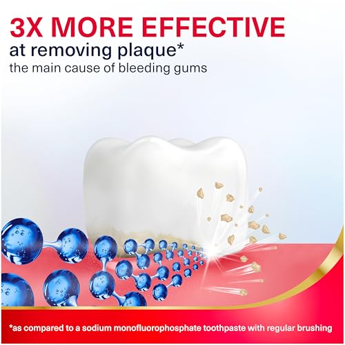 Parodontax Active Gum Repair Toothpaste, Toothpaste To Help Reverse Signs Of Early Disease For Health, Fresh Mint Flavored - 3.4 Oz x 3